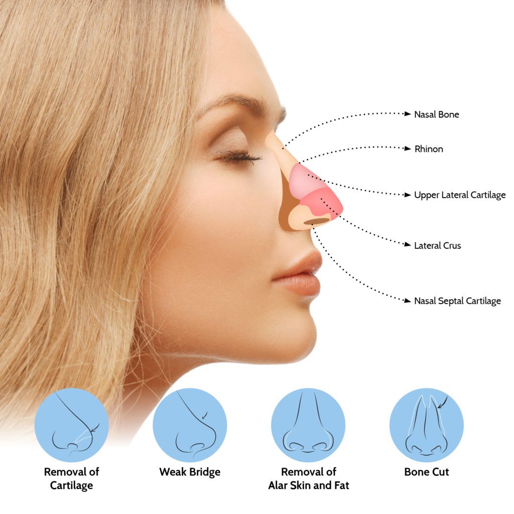 nasal reconstruction at jefferson facial plastics