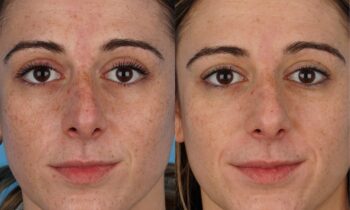 Jefferson Facial Plastics side by side